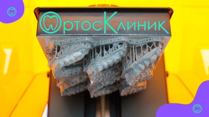 Ортодонтическое лечение в ОРТОСКЛИНИК